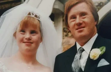 2 سندرم داون و ازدواج: امکان زندگی مشترک برای افراد معلول