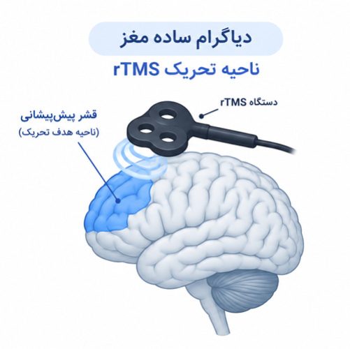 دیاگرام-ساده-مغز-—-ناحیه-تحریک-rTMS