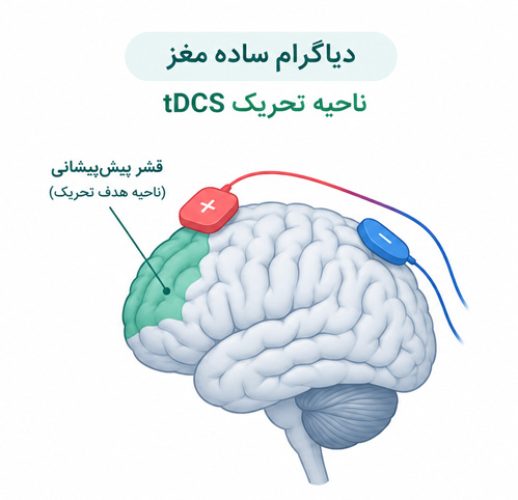 دیاگرام-ساده-مغز-—-ناحیه-تحریک-tDCS